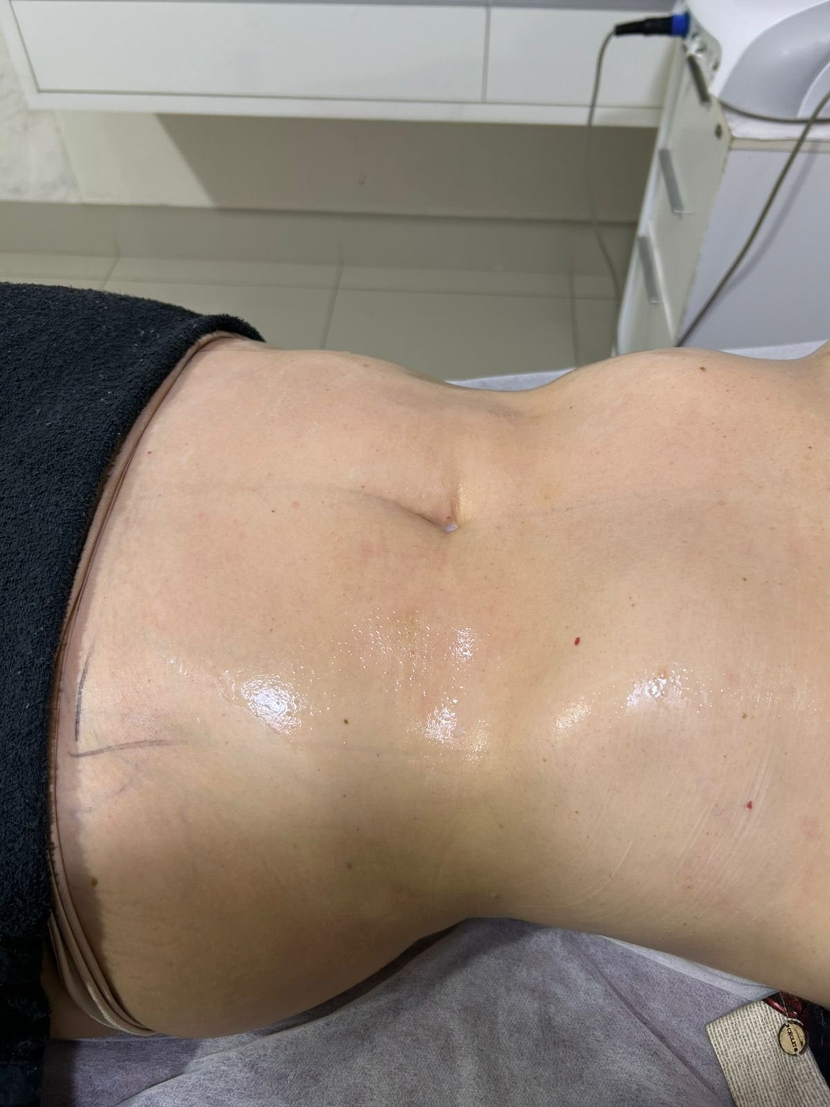 Depois - Protocolo Personalizado