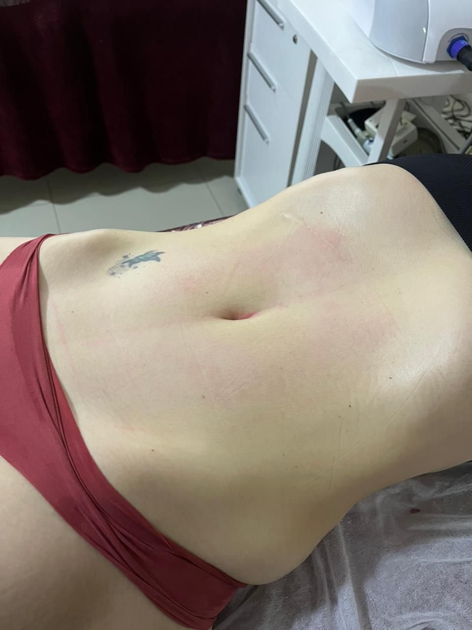 Depois - Protocolo Personalizado