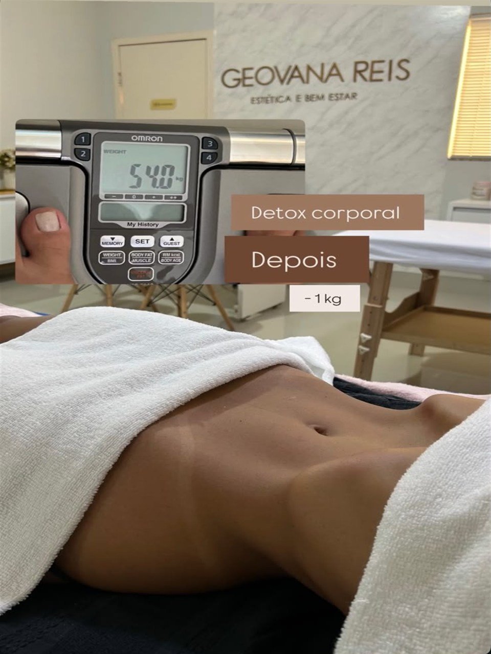 Depois - Protocolo Personalizado