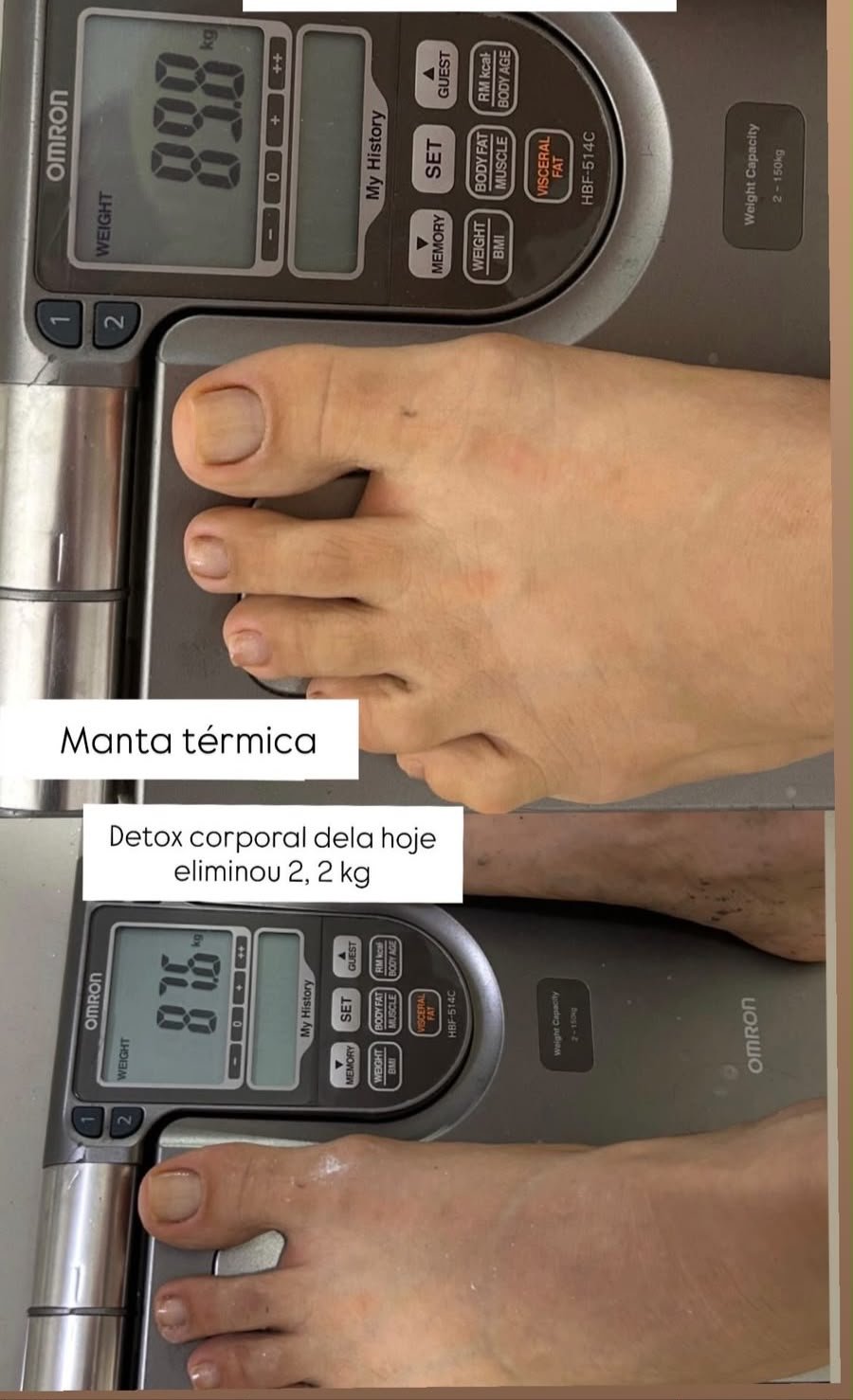 Resultado - Protocolo Personalizado